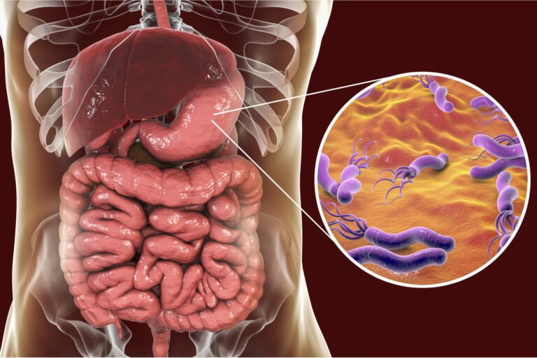 Intestinal infection treatment illustration showing bacteria affecting digestive system and intestines