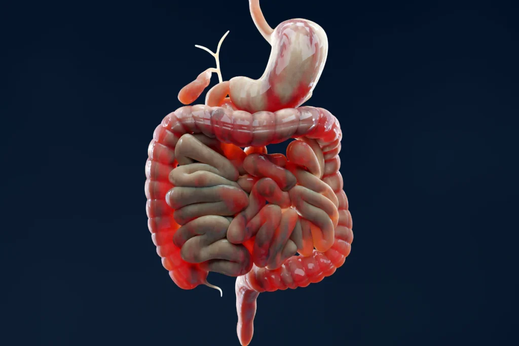 Digestive system inflammation illustration for gut health checkup and treatment