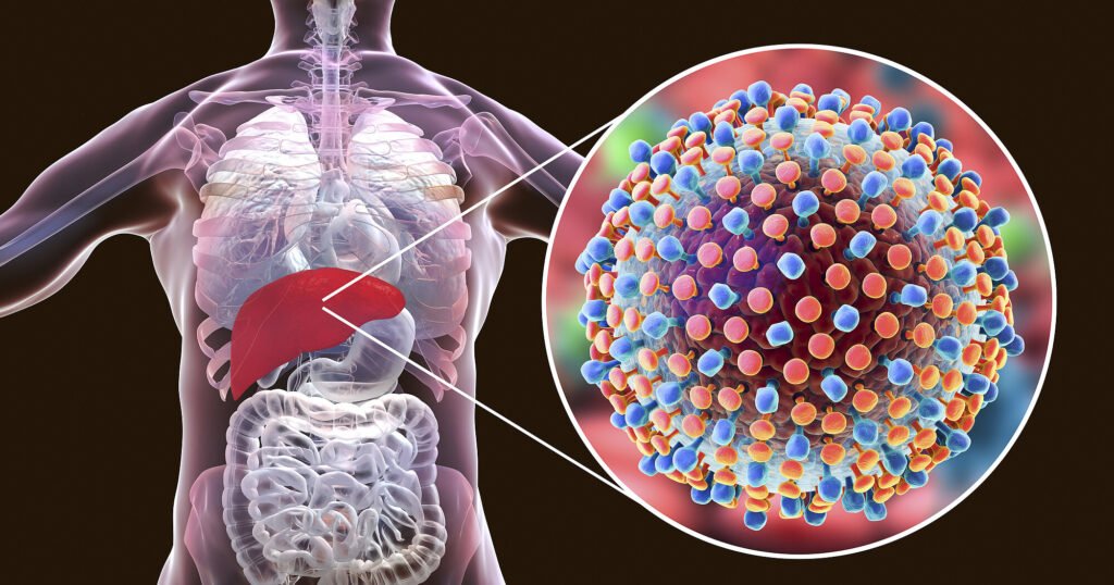 Hepatitis A, B and C infection affecting liver with virus illustration