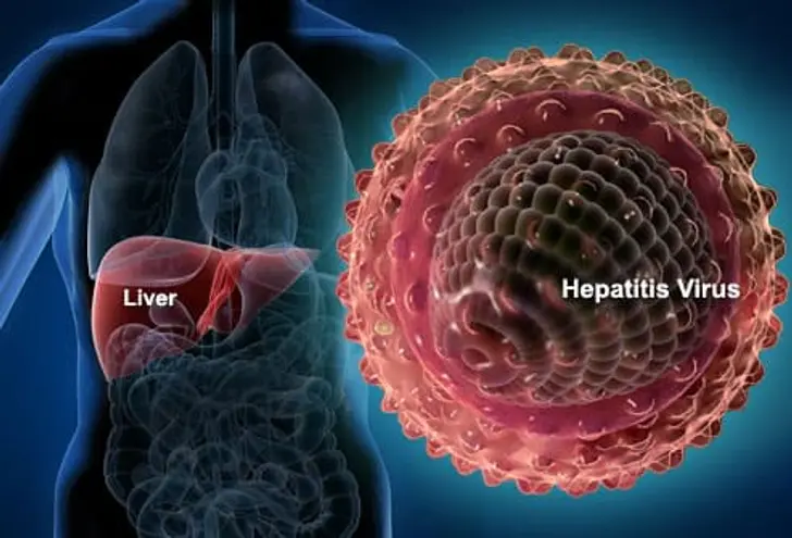 Hepatitis virus infection affecting liver showing Hepatitis A B and C liver disease