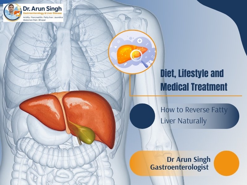 How to reverse fatty liver naturally with diet, lifestyle changes and medical treatment by Dr Arun Singh gastroenterologist providing Fatty Liver treatment in Bhopal